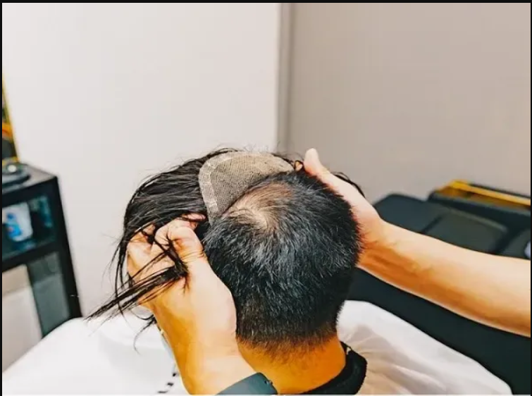 Hair Patch