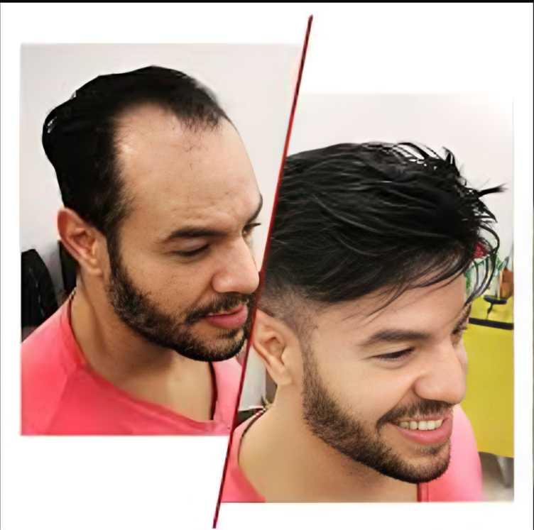 Hair Transformation